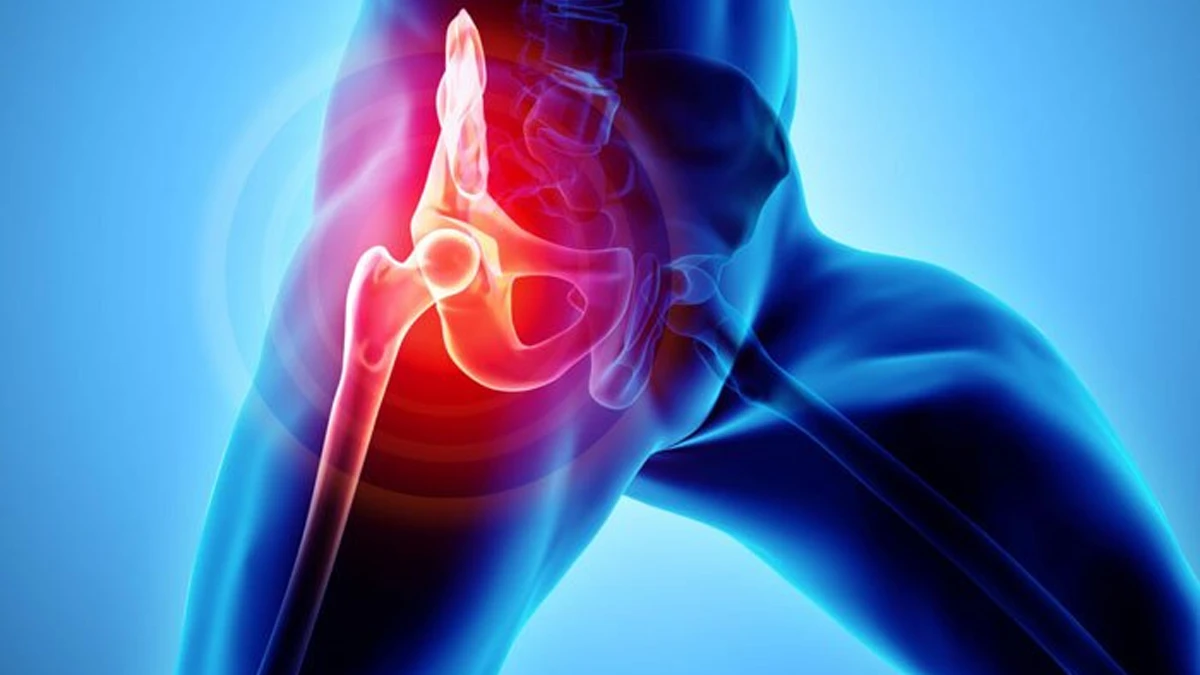 Kalça ekleminde uyluk kemiği başının kırmızı vurgulandığı anatomik görsel