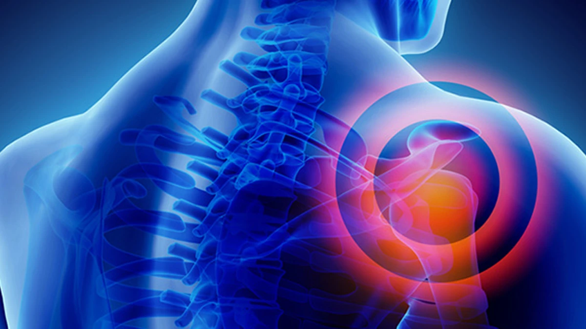 Omuz ekleminin ağrı halkalarıyla vurgulandığı boyun ve omuz anatomisi görseli